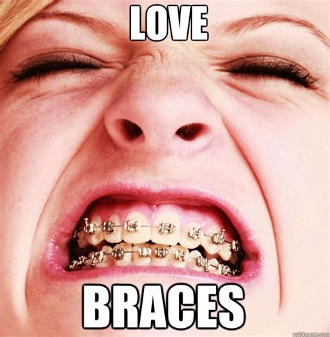 braces girl meme.